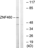 ZNF460 Antibody in Western Blot (WB)