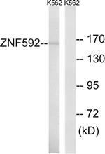 ZNF592 Antibody in Western Blot (WB)