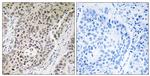 ZNF608 Antibody in Immunohistochemistry (Paraffin) (IHC (P))