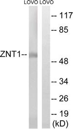 SLC30A1 Antibody in Western Blot (WB)