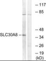SLC30A8 Antibody in Western Blot (WB)
