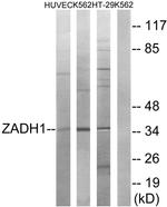 PTGR2 Antibody in Western Blot (WB)