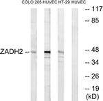 ZADH2 Antibody in Western Blot (WB)