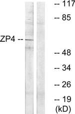 ZP4 Antibody in Western Blot (WB)