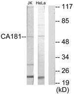 ZNHIT6 Antibody in Western Blot (WB)