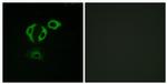 TACC3 Antibody in Immunocytochemistry (ICC/IF)