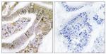 TACC3 Antibody in Immunohistochemistry (Paraffin) (IHC (P))