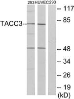 TACC3 Antibody in Western Blot (WB)