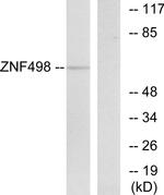 ZNF498 Antibody in Western Blot (WB)