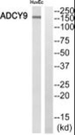 Adenylate Cyclase 9 Antibody in Western Blot (WB)