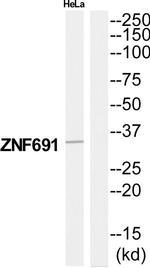 ZNF691 Antibody in Western Blot (WB)