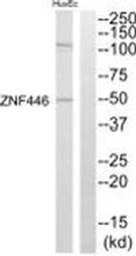 ZNF446 Antibody in Western Blot (WB)