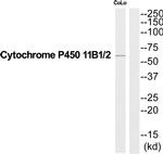 CYP11B1/CYP11B2 Antibody in Western Blot (WB)