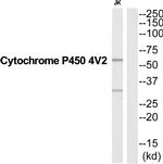 CYP4V2 Antibody in Western Blot (WB)
