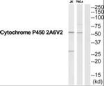 CYP2A6 Antibody in Western Blot (WB)