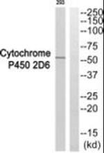 CYP2D6 Antibody in Western Blot (WB)