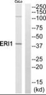 ERI1 Antibody in Western Blot (WB)