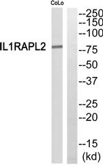 IL1RAPL2 Antibody in Western Blot (WB)