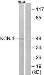 Kir3.4 (KCNJ5) Antibody in Western Blot (WB)