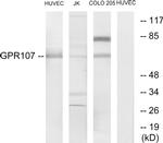 GPR107 Antibody in Western Blot (WB)