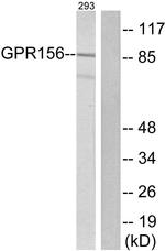 GPR156 Antibody in Western Blot (WB)