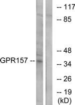 GPR157 Antibody in Western Blot (WB)