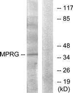 mPR gamma Antibody in Western Blot (WB)