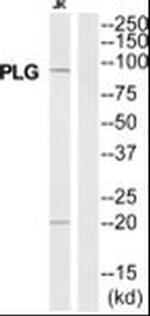 GPROPDR Antibody in Western Blot (WB)