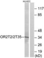 OR2T2/OR2T35 Antibody in Western Blot (WB)