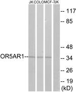 OR5AR1 Antibody in Western Blot (WB)