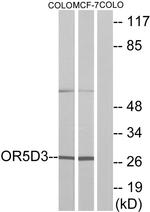OR5D3 Antibody in Western Blot (WB)