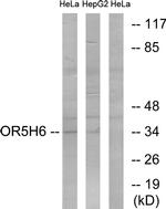 OR5H6 Antibody in Western Blot (WB)