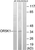 OR5K1 Antibody in Western Blot (WB)