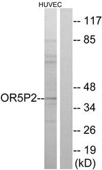 OR5P2 Antibody in Western Blot (WB)