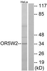 OR5W2 Antibody in Western Blot (WB)