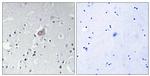 Phospho-c-Abl (Tyr393, Tyr412) Antibody in Immunohistochemistry (Paraffin) (IHC (P))