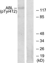 Phospho-c-Abl (Tyr393, Tyr412) Antibody in Western Blot (WB)