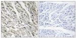 Phospho-CPI-17 (Thr38) Antibody in Immunohistochemistry (Paraffin) (IHC (P))