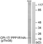 Phospho-CPI-17 (Thr38) Antibody in Western Blot (WB)