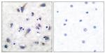 Phospho-DARPP-32 (Thr34) Antibody in Immunohistochemistry (Paraffin) (IHC (P))