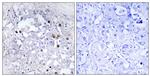 Phospho-HNF4A (Ser313) Antibody in Immunohistochemistry (Paraffin) (IHC (P))