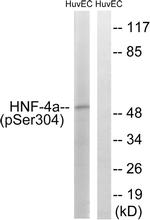 Phospho-HNF4A (Ser313) Antibody in Western Blot (WB)