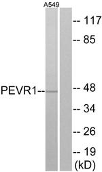 SLC52A2 Antibody in Western Blot (WB)