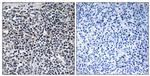 Phospho-Stathmin 1 (Ser15) Antibody in Immunohistochemistry (Paraffin) (IHC (P))
