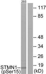 Phospho-Stathmin 1 (Ser15) Antibody in Western Blot (WB)