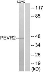 SLC52A1 Antibody in Western Blot (WB)