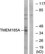 TMEM185A Antibody in Western Blot (WB)