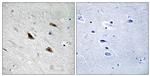 Phospho-beta Catenin (Tyr489) Antibody in Immunohistochemistry (Paraffin) (IHC (P))