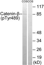 Phospho-beta Catenin (Tyr489) Antibody in Western Blot (WB)