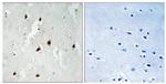 Phospho-FOXO4 (Ser262) Antibody in Immunohistochemistry (Paraffin) (IHC (P))